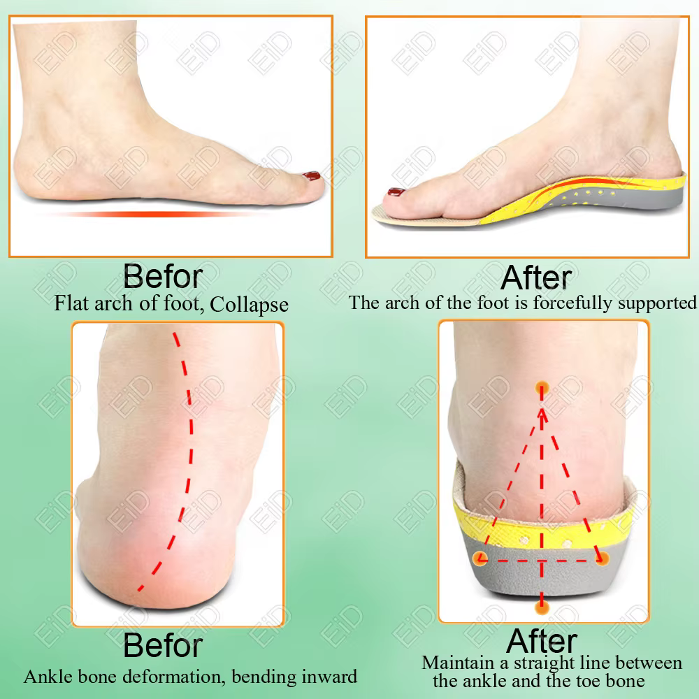 Semelles orthopédiques en gel de qualité supérieure unisexe, pied plat 4WD, semelle de santé pour ch