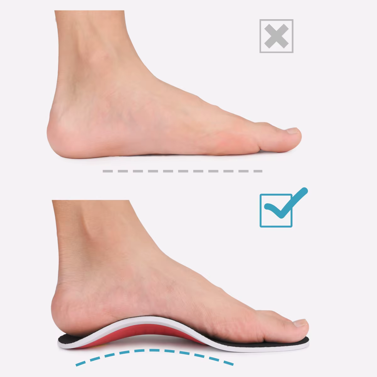 Semelles orthopédiques pour hommes et femmes pour fasciite plantaire